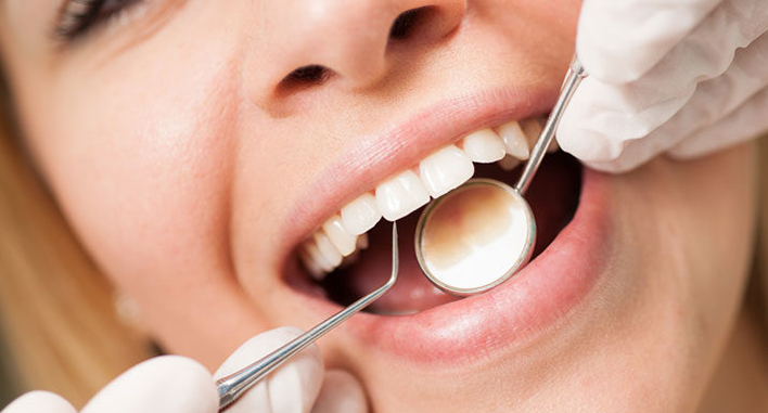 Why You Require Routine Teeth Cleanings