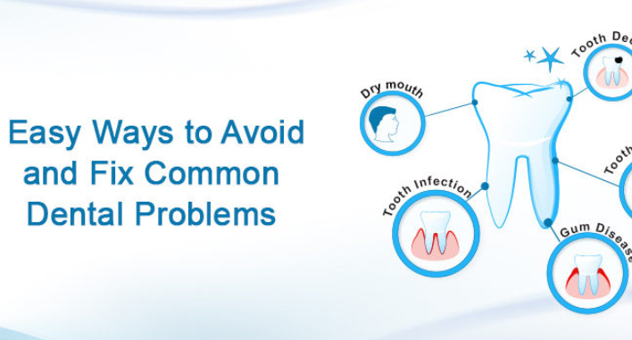Avoid common dental Problems