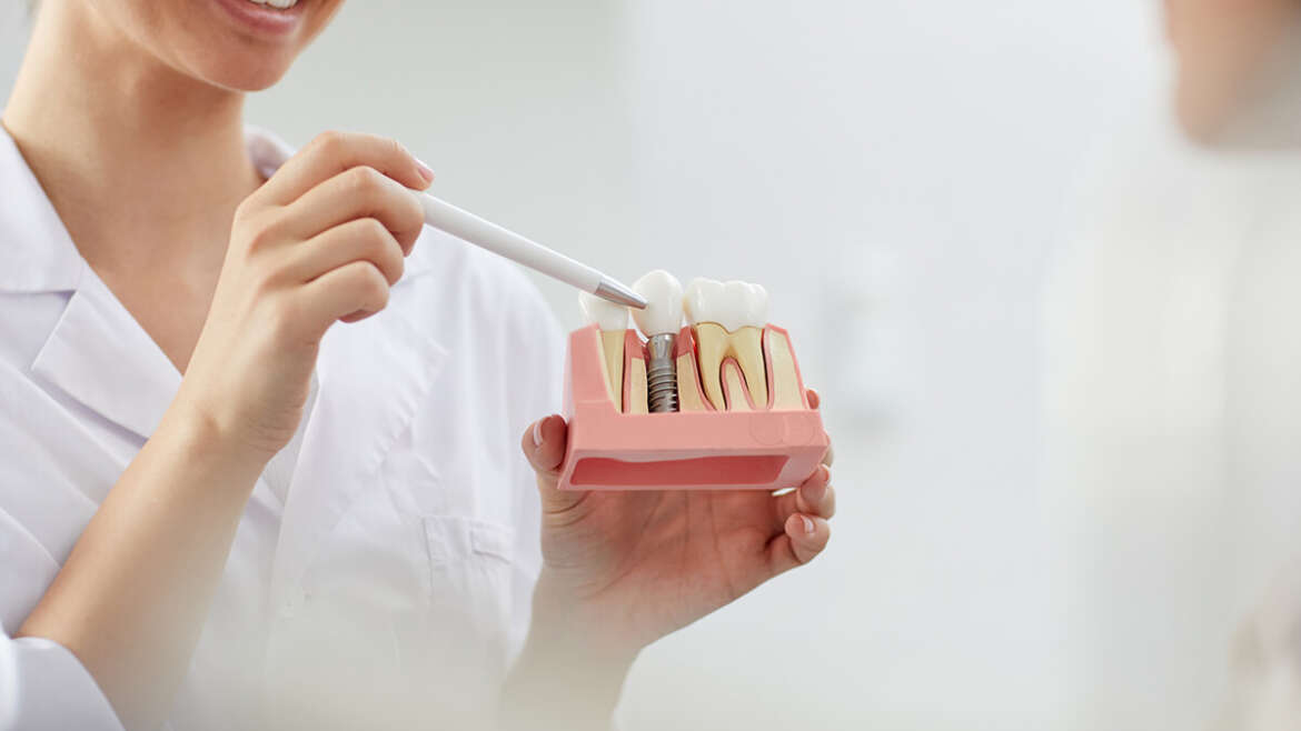 5 Important Reasons Dental Implants are beneficial to your health 